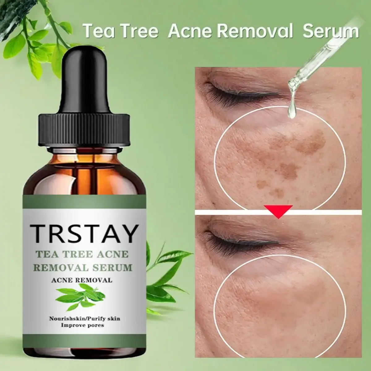 Acne Treatment Face Serum Tea Tree Oil Essence Moisturizing Shrink Pores Acne Facial Serum Korean Skin Care Products